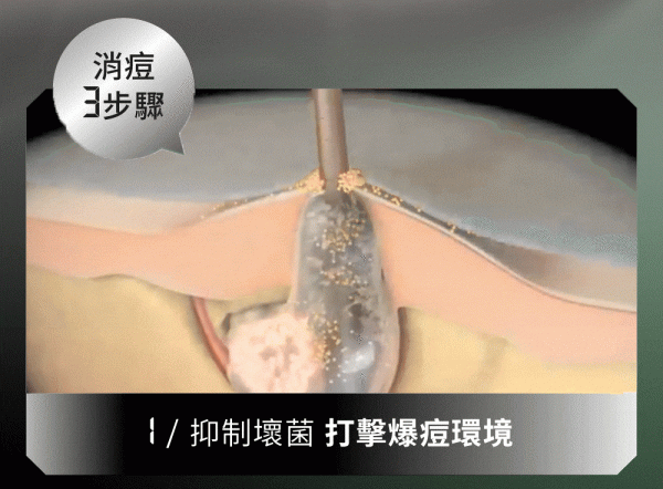 台灣Relove全酵肌泌控油零痘濃萃 50ml - 香港行貨